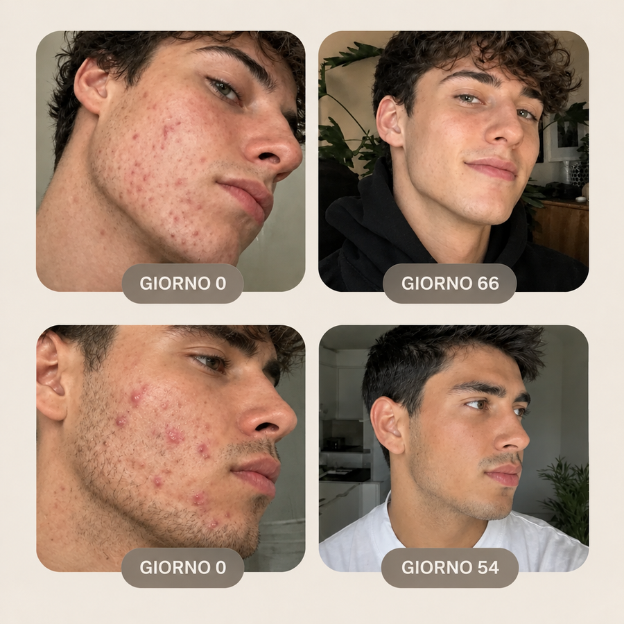 Prima e dopo